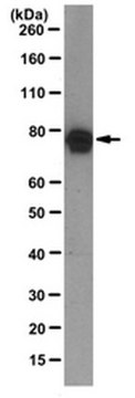 Anti-Exo70 Antibody, clone 70X13F3 clone 70X13F3, from mouse