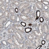 Anti-SSTR2 antibody produced in rabbit Prestige Antibodies® Powered by Atlas Antibodies, affinity isolated antibody, buffered aqueous glycerol solution