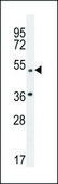 ANTI-AP1M1 (CENTER) antibody produced in rabbit IgG fraction of antiserum, buffered aqueous solution