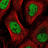 Anti-GTF2A2 antibody produced in rabbit Prestige Antibodies® Powered by Atlas Antibodies, affinity isolated antibody