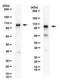 Anti-FOXK1 (MNF) from rabbit, purified by affinity chromatography
