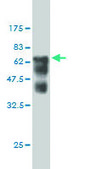 Monoclonal Anti-SMS antibody produced in mouse clone 1G6, purified immunoglobulin, buffered aqueous solution
