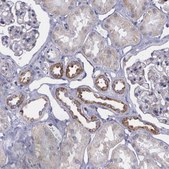 Anti-SYNJ2BP antibody produced in rabbit Prestige Antibodies® Powered by Atlas Antibodies, affinity isolated antibody, buffered aqueous glycerol solution
