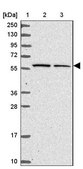 Anti-KLHL3 antibody produced in rabbit Prestige Antibodies® Powered by Atlas Antibodies, affinity isolated antibody, buffered aqueous glycerol solution