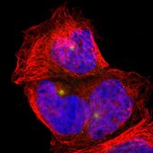 Anti-PLA2G6 antibody produced in rabbit Prestige Antibodies® Powered by Atlas Antibodies, affinity isolated antibody, buffered aqueous glycerol solution