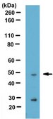 Anti-THAP11 (Ronin) Antibody from rabbit, purified by affinity chromatography