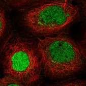 Anti-ITCH antibody produced in rabbit Prestige Antibodies® Powered by Atlas Antibodies, affinity isolated antibody