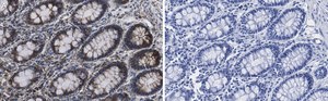 Anti-Mn-SOD Antibody, clone 1C14 ZooMAb® Rabbit Monoclonal recombinant, expressed in HEK 293 cells