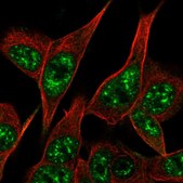 Anti-PARK2 antibody produced in rabbit Prestige Antibodies® Powered by Atlas Antibodies, affinity isolated antibody