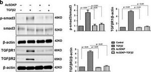 Anti-TGF β Receptor I antibody produced in rabbit affinity isolated antibody
