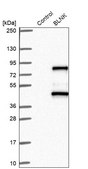 Anti-BLNK antibody produced in rabbit Prestige Antibodies® Powered by Atlas Antibodies, affinity isolated antibody, buffered aqueous glycerol solution