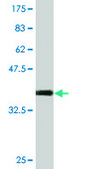 Monoclonal Anti-STK31, (C-terminal) antibody produced in mouse clone 1C10, purified immunoglobulin, buffered aqueous solution