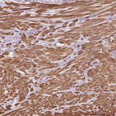 Anti-TBC1D2B antibody produced in rabbit Prestige Antibodies® Powered by Atlas Antibodies, affinity isolated antibody, buffered aqueous glycerol solution