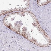 Anti-SELENOH antibody produced in rabbit Prestige Antibodies® Powered by Atlas Antibodies, affinity isolated antibody, buffered aqueous glycerol solution
