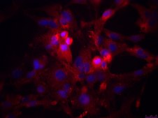 TB096 Human IDH1-Mutated Astrocytoma Cell Line