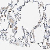 Anti-PPBP antibody produced in rabbit Prestige Antibodies® Powered by Atlas Antibodies, affinity isolated antibody, buffered aqueous glycerol solution