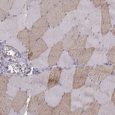 Anti-UCP3 antibody produced in rabbit Prestige Antibodies® Powered by Atlas Antibodies, affinity isolated antibody