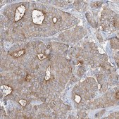 Anti-ADCK2 antibody produced in rabbit Prestige Antibodies® Powered by Atlas Antibodies, affinity isolated antibody, buffered aqueous glycerol solution