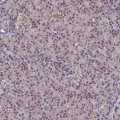 Anti-PPHLN1 antibody produced in rabbit Prestige Antibodies® Powered by Atlas Antibodies, affinity isolated antibody, buffered aqueous glycerol solution