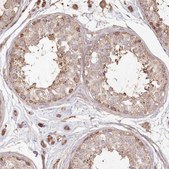 Anti-HAL antibody produced in rabbit Prestige Antibodies® Powered by Atlas Antibodies, affinity isolated antibody, buffered aqueous glycerol solution