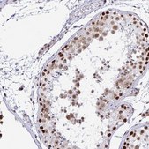 Anti-SUPT16H antibody produced in rabbit Prestige Antibodies® Powered by Atlas Antibodies, affinity isolated antibody, buffered aqueous glycerol solution