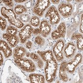 Anti-IL22RA2 antibody produced in rabbit Prestige Antibodies® Powered by Atlas Antibodies, affinity isolated antibody, buffered aqueous glycerol solution