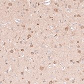 Anti-NELL1 antibody produced in rabbit Prestige Antibodies® Powered by Atlas Antibodies, affinity isolated antibody, buffered aqueous glycerol solution