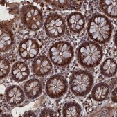 Anti-PLA2G15 antibody produced in rabbit Prestige Antibodies® Powered by Atlas Antibodies, affinity isolated antibody, buffered aqueous glycerol solution