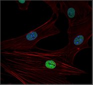 Anti-trimethyl Histone H3 (Lys27) Antibody, clone 18E9.1, Alexa Fluor™ 488 Conjugate clone 18E9.1, from mouse, ALEXA FLUOR™ 488