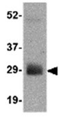 Anti-NIPSNAP2 Antibody from rabbit, purified by affinity chromatography