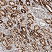 Anti-NDUFAF3 antibody produced in rabbit Prestige Antibodies® Powered by Atlas Antibodies, affinity isolated antibody, buffered aqueous glycerol solution