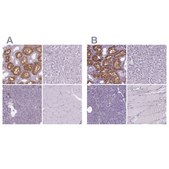 Anti-CLIC4 antibody produced in rabbit Prestige Antibodies® Powered by Atlas Antibodies, affinity isolated antibody, buffered aqueous glycerol solution