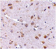 Anti-SATB1 Antibody from rabbit, purified by affinity chromatography