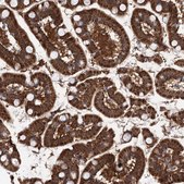 Anti-PTGR1 antibody produced in rabbit Prestige Antibodies® Powered by Atlas Antibodies, affinity isolated antibody, buffered aqueous glycerol solution