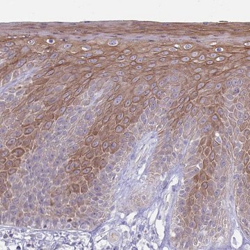 Anti-CDKN2B antibody produced in rabbit Prestige Antibodies® Powered by Atlas Antibodies, affinity isolated antibody, buffered aqueous glycerol solution