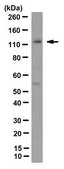 Anti-SREBP-2 Antibody, clone 22D5 clone 22D5, from rabbit