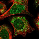 Anti-ANKRD52 antibody produced in rabbit Prestige Antibodies® Powered by Atlas Antibodies, affinity isolated antibody, buffered aqueous glycerol solution