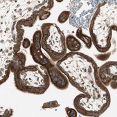Anti-PFDN5 antibody produced in rabbit affinity isolated antibody, buffered aqueous glycerol solution