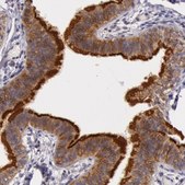 Anti-CDK16 antibody produced in rabbit Prestige Antibodies® Powered by Atlas Antibodies, affinity isolated antibody, buffered aqueous glycerol solution