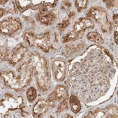 Anti-ANXA11 antibody produced in rabbit Prestige Antibodies® Powered by Atlas Antibodies, affinity isolated antibody, buffered aqueous glycerol solution