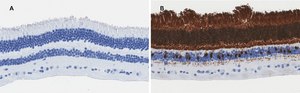 Anti-Recoverin Antibody, clone 1J23, ZooMAb® Rabbit Monoclonal recombinant, expressed in HEK 293 cells