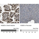 Anti-ACBD5 antibody produced in rabbit Prestige Antibodies® Powered by Atlas Antibodies, affinity isolated antibody, buffered aqueous glycerol solution