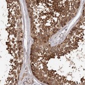 Anti-VPS37A antibody produced in rabbit Prestige Antibodies® Powered by Atlas Antibodies, affinity isolated antibody, buffered aqueous glycerol solution, ab2