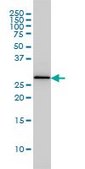 Monoclonal Anti-PSME2 antibody produced in mouse clone 1G4, purified immunoglobulin, buffered aqueous solution