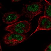 Anti-TAF8 antibody produced in rabbit Prestige Antibodies® Powered by Atlas Antibodies, affinity isolated antibody, buffered aqueous glycerol solution