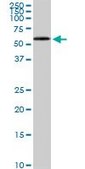 Monoclonal Anti-HDAC1 antibody produced in mouse clone 3E1, purified immunoglobulin, buffered aqueous solution