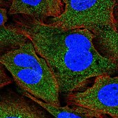 Anti-SNF8 antibody produced in rabbit Prestige Antibodies® Powered by Atlas Antibodies, affinity isolated antibody, buffered aqueous glycerol solution