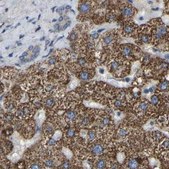 Anti-GCC1 antibody produced in rabbit Prestige Antibodies® Powered by Atlas Antibodies, affinity isolated antibody, buffered aqueous glycerol solution