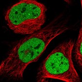 Anti-CTBP1 antibody produced in rabbit Prestige Antibodies® Powered by Atlas Antibodies, affinity isolated antibody, buffered aqueous glycerol solution
