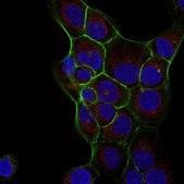 Anti-Ras Antibody, clone RAS10, Alexa Fluor™ 647 Conjugate clone RAS10, from mouse, ALEXA FLUOR™ 647